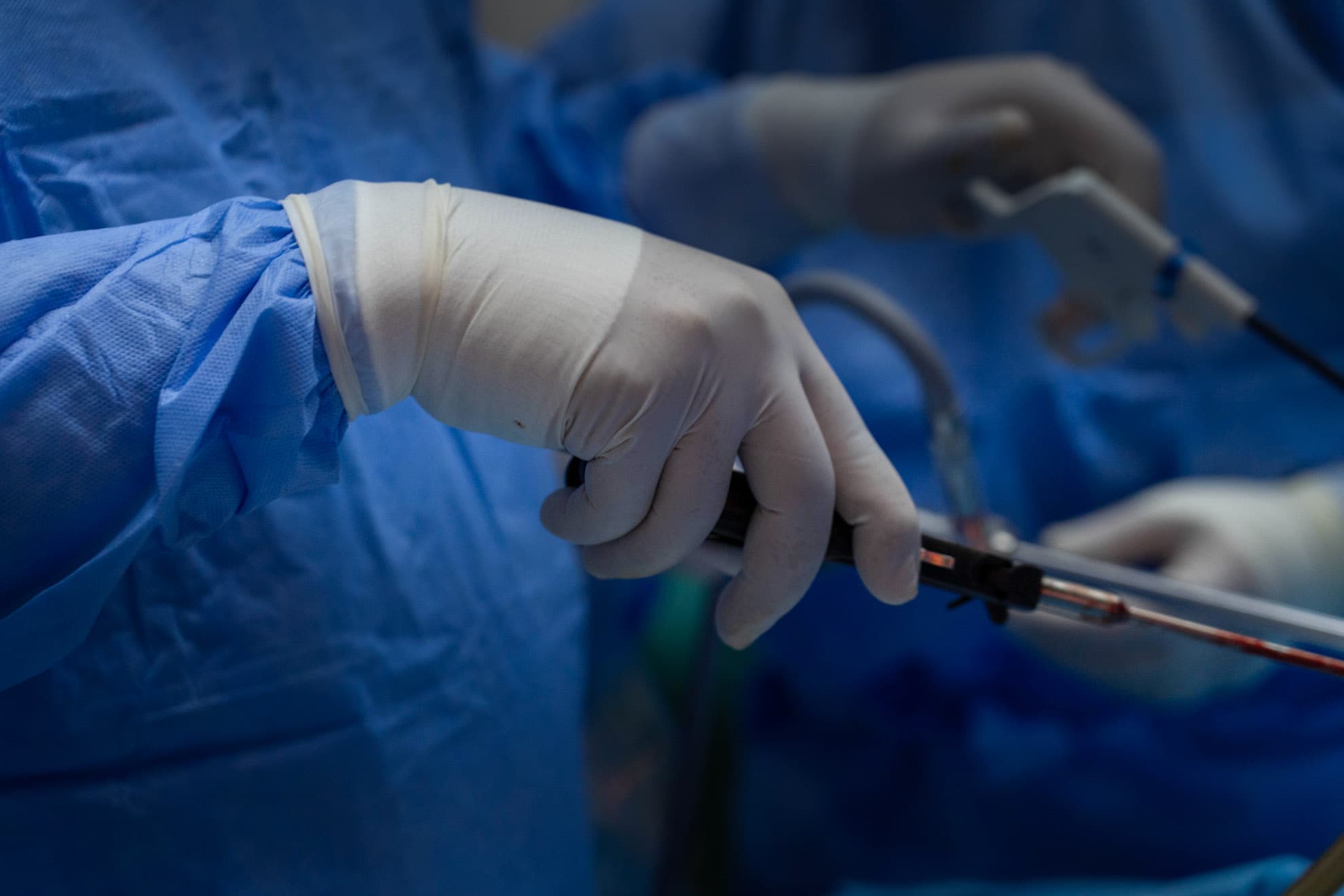 Bariatric Surgical Instrument in Use – Precision Medical Device Handling