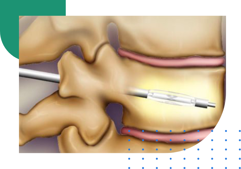 LSO_MDM_OrthopedicCollage