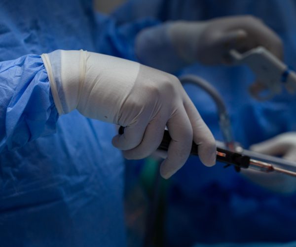 Close-up of a surgeon's gloved hands operating a bariatric surgical device during a procedure, highlighting precision and sterile technique.