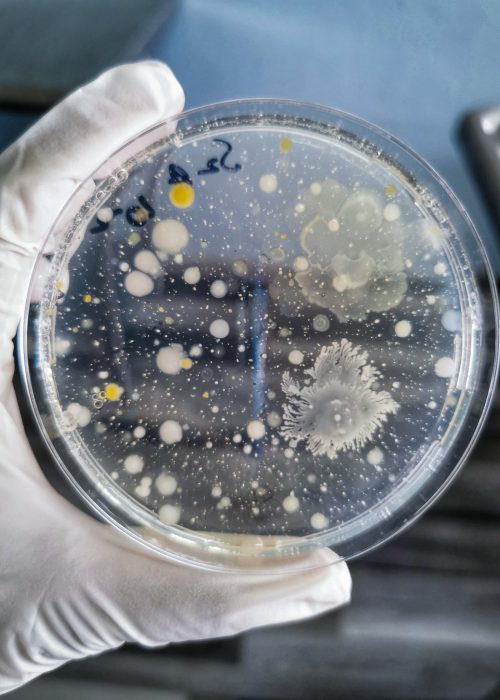 Microbial Growth on Agar Plate – Bioburden Testing Close-up of a gloved hand holding a petri dish with microbial colonies growing on agar, used for bioburden testing in laboratory environments.