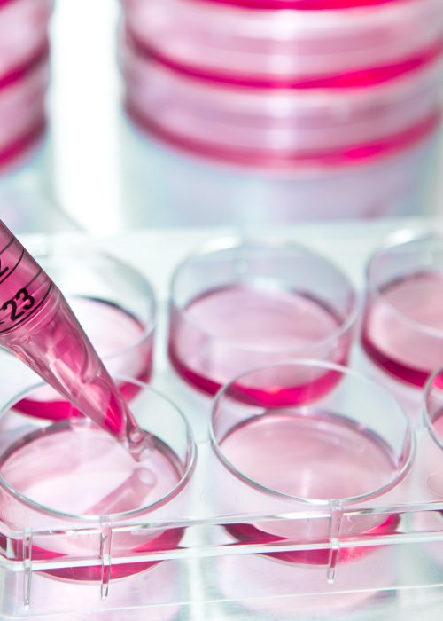Cell Culture Assay for Cytotoxicity Testing in 6-Well Plate with Pipette Close-up of a pipette dispensing pink culture media into a 6-well plate during cytotoxicity cell assay testing for medical device evaluation.