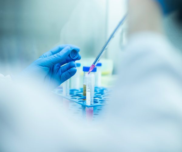 Medical lab technician pipetting cell culture media into test tubes during cytotoxicity testing for medical device biocompatibility in a sterile lab.